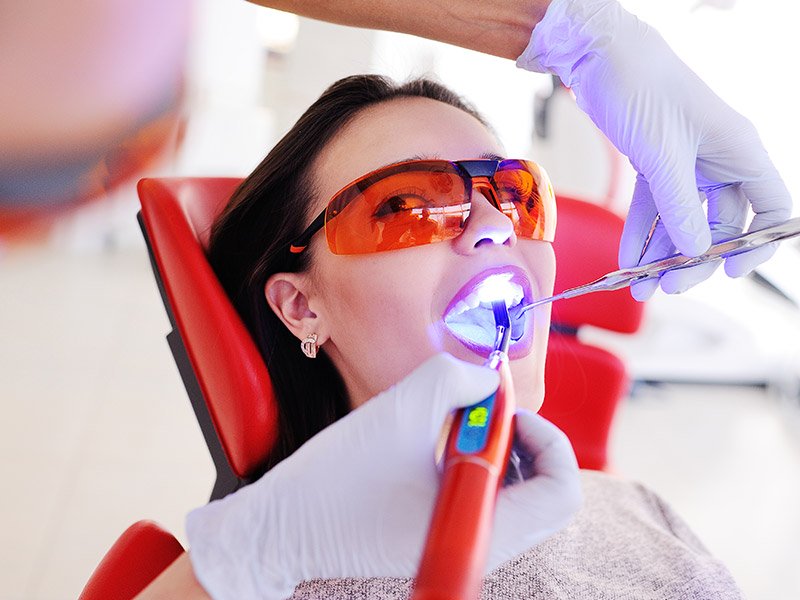 Clareamento a laser em Sorocaba/SP